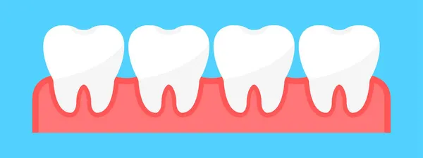 健康な歯がセット 歯茎に歯がある 歯科クリニックでの歯科治療 フラットスタイル ベクターイラスト — ストック写真