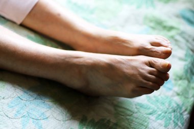 Hemşireye uzanmış yaşlı bir kadının ayaklarına yakın çekim.