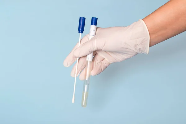 Test Coronavirus Doctors Hand Blue Background Medical Concept Close — Stock Photo, Image