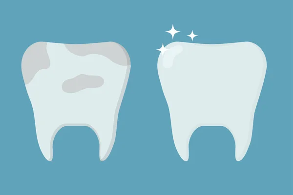 Gezonde Schone Tand Tand Met Plaque Model Voor Stomatologie Tandheelkunde — Stockvector
