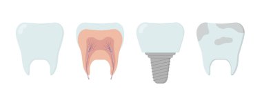 Temiz diş, diş implantı, kirli diş, içinde diş. Stomatoloji ya da dişçilik şablonu. İzole vektör illüstrasyonu
