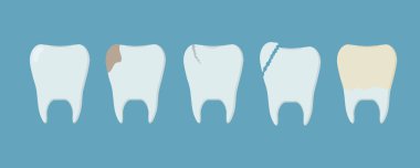 Farklı yaralanmış insan dişleri. Sağlıklı diş, dişleri, bakımı, plaketi, çatlağı ve kırık. Stomatoloji ya da dişçilik şablonu. Diş bakımı kavramı
