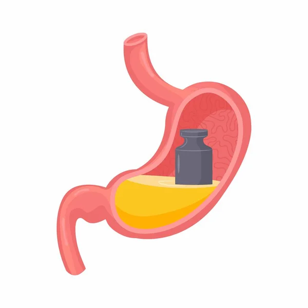 Lourdeur Dans Estomac Illustration Vectorielle Isolée Problème Gaz Élément Conception — Image vectorielle