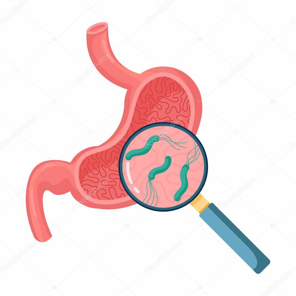 Helicobacter Pylori in the stomach. Stomach diseases. Bacterium with flagella that causes gastritis. Bacteria under magnifying glass. Vector illustration on white background