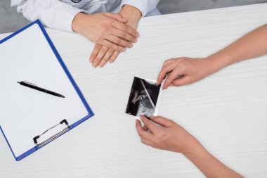 Doktor ve kadının ultrason yakınındaki kısmi görüntüsü. Hamilelik onayı ve masa başında boş bir pano var.