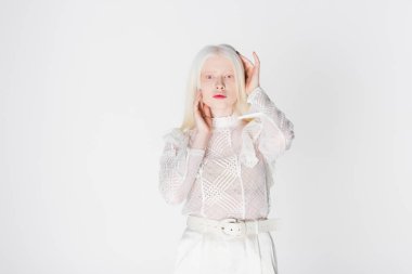 Bluzlu albino model beyaz kameraya bakıyor. 