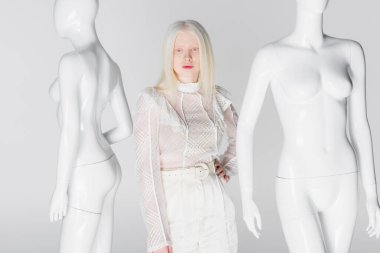 Sarışın ve albino kadın, eli kalçasında, beyaz tenli mankenlerin yanında. 