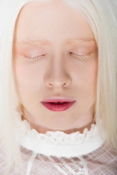 Retrato Mujer Albina Joven Con Los Ojos Cerrados — Foto de Stock