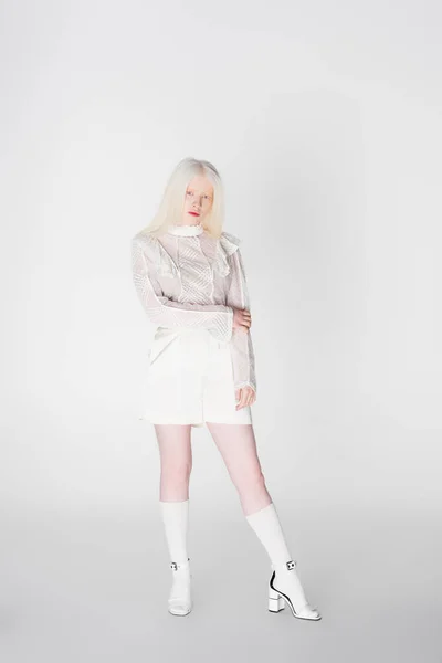 Mulher Albino Bonita Sandálias Blusa Olhando Para Câmera Fundo Branco — Fotografia de Stock