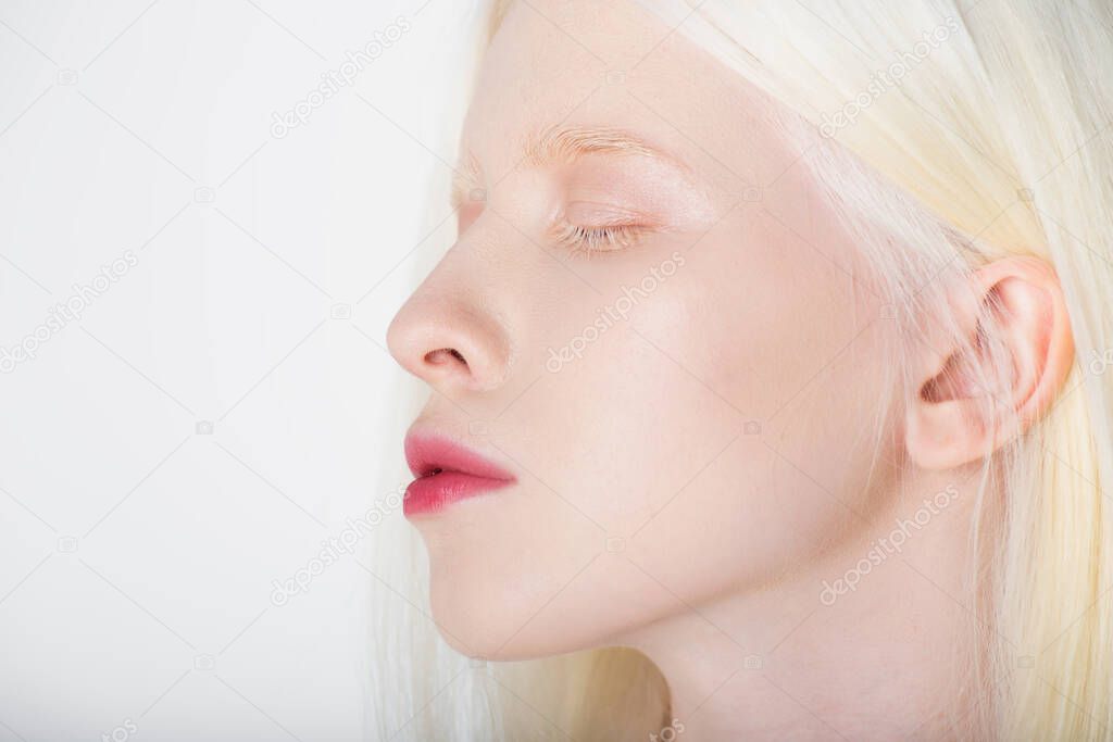 Young albino woman closing eyes isolated on white 