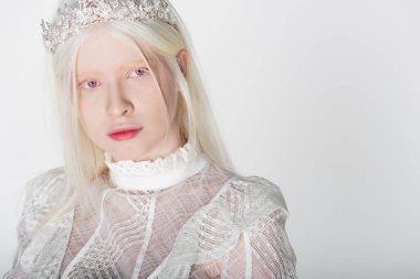 Taçlı ve bluzlu genç albino kadın portresi beyaza izole edilmiş kameraya bakıyor.