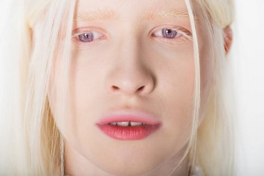 Portrait of young albino woman looking away isolated on white clipart
