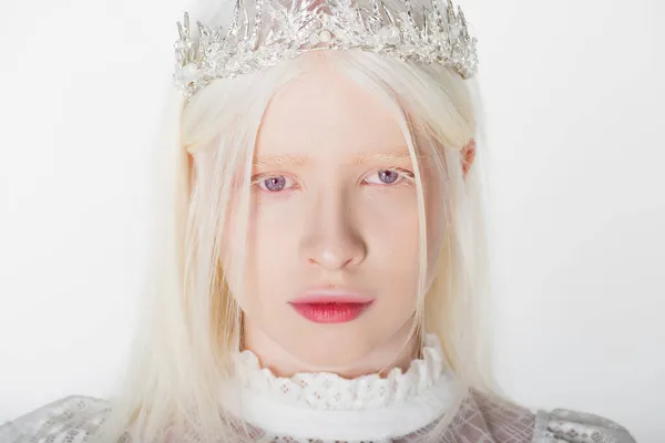 Portret Van Albino Vrouw Kroon Met Parels Geïsoleerd Wit — Stockfoto