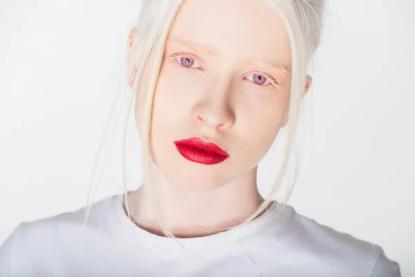 Portret Albinoski Czerwonymi Ustami Białym Shircie Patrzącej Kamerę Odizolowaną Białym — Zdjęcie stockowe
