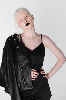 Siyah deri ceketli, modaya uygun bir albino model, beyaz tenli kalça üzerinde el ele tutuşuyor.