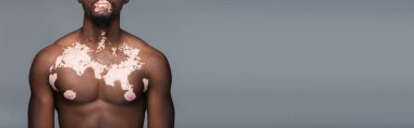 cropped view of shirtless african american man with vitiligo skin and muscular torso  isolated on grey, banner