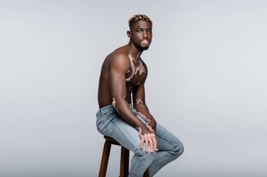 shirtless african american man with vitiligo looking at camera while sitting on stool in jeans isolated on grey