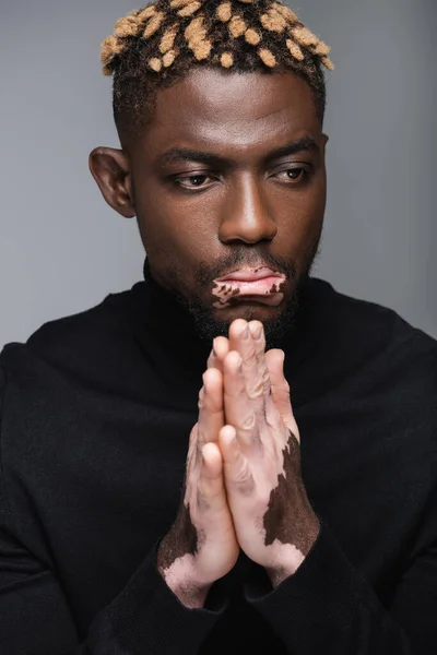 Stylish African American Man Vitiligo Skin Praying Hands Isolated Grey — Stock fotografie