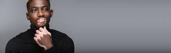 Скептичний Афроамериканський Чоловік Шкірою Вітіліго Торкається Підборіддя Ізольовано Сірому Банер — стокове фото