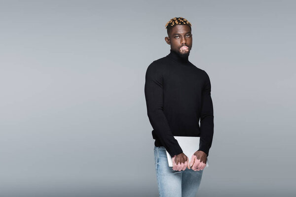 trendy african american man with vitiligo, in black turtleneck and jeans, posing with laptop isolated on grey