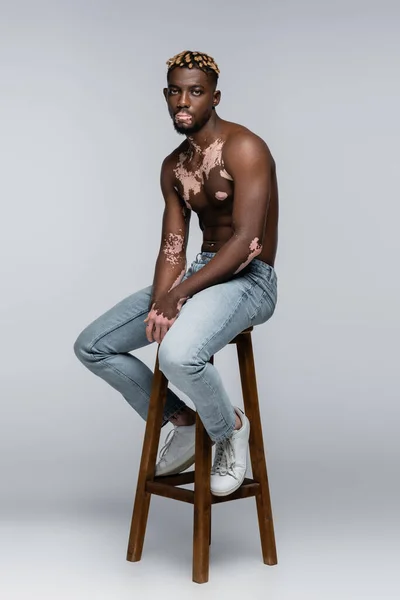 Shirtless African American Man Vitiligo Looking Camera While Sitting Stool — Stockfoto