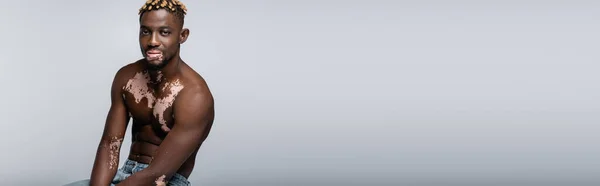 Young African American Man Vitiligo Trendy Hairstyle Sitting Grey Banner — Stockfoto