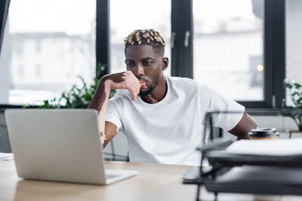 Hombre Afroamericano Serio Con Vitiligo Pensando Cerca Borrosa Portátil Oficina — Foto de Stock