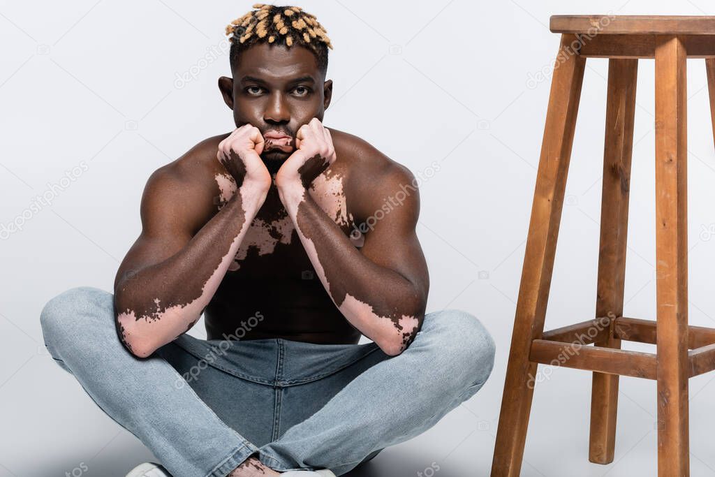 shirtless african american man with vitiligo skin sitting with crossed legs and hands near face near high stool on grey