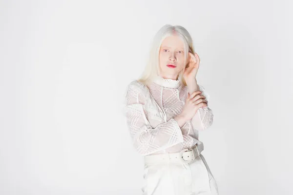 Pretty albino woman looking at camera isolated on white — Stock Photo