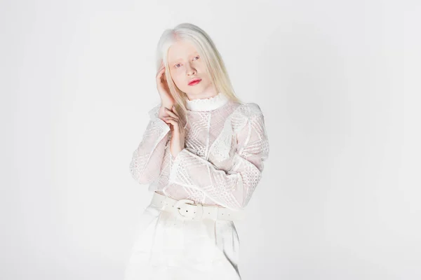 Jeune femme albinos et blonde posant isolée sur blanc — Photo de stock
