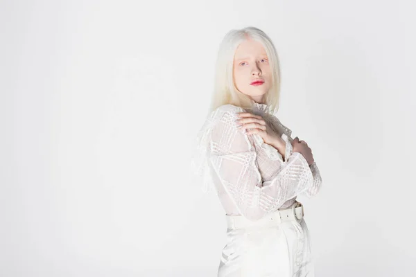 Pretty albino woman looking at camera while posing isolated on white — Stock Photo