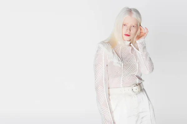 Mulher albino elegante olhando para a câmera isolada no branco — Fotografia de Stock