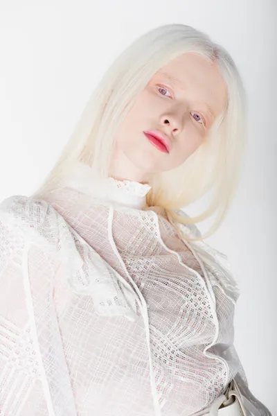 Портрет молодої альбінової жінки, яка дивиться ізольовано на білому — стокове фото