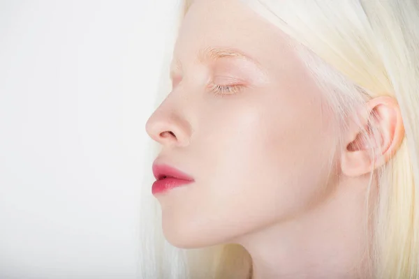 Mujer albina joven cerrando los ojos aislados en blanco - foto de stock