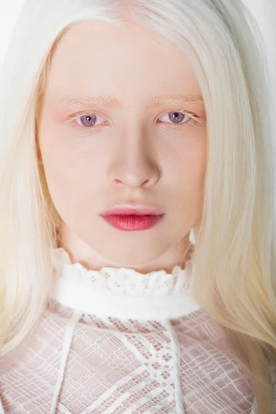Portrait of albino woman looking at camera isolated on white — Stock Photo