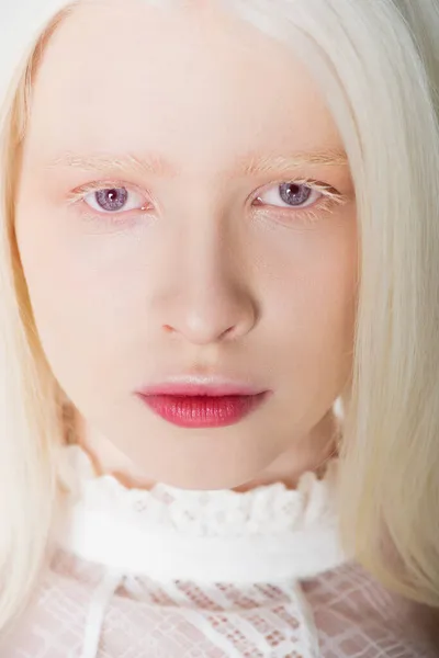 Retrato de mulher albina loira olhando para a câmera isolada no branco — Fotografia de Stock