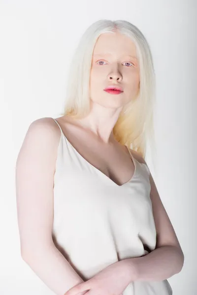 Mujer albina en vestido mirando a la cámara aislada en blanco - foto de stock