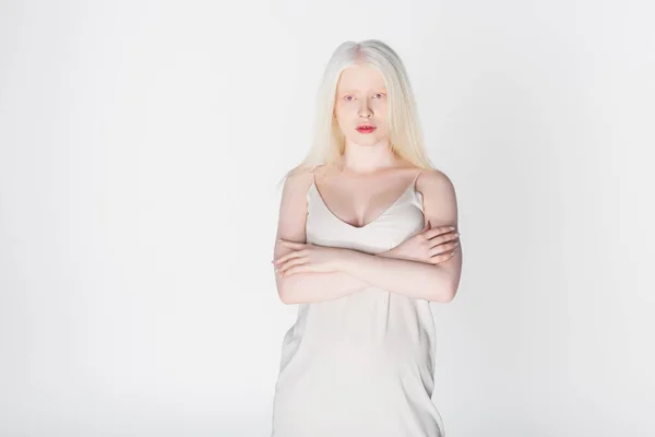 Albino woman in dress standing with crossed arms isolated on white — Stock Photo