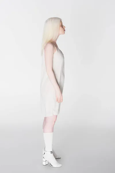 Vue latérale de la femme albinos élégant debout sur fond blanc — Photo de stock