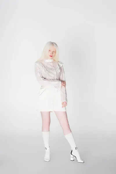 Mulher albino bonita em sandálias e blusa olhando para a câmera no fundo branco — Fotografia de Stock