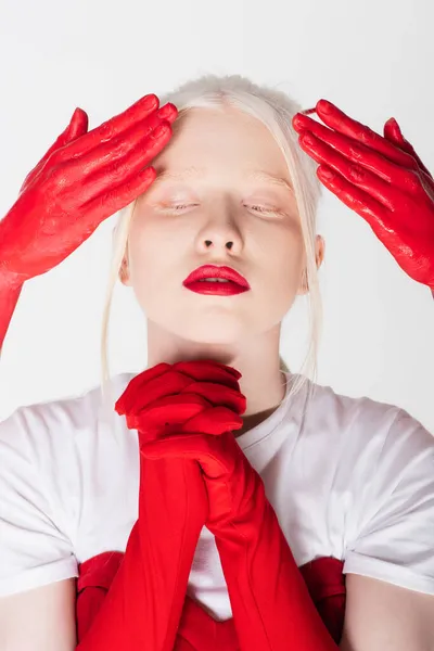 Modelo Albino com lábios vermelhos em pé perto de mãos femininas em tinta isolada em branco — Fotografia de Stock