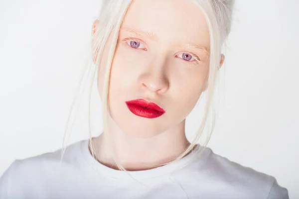 Porträt einer Albino-Frau mit roten Lippen im weißen T-Shirt, die isoliert auf weiß in die Kamera blickt — Stockfoto