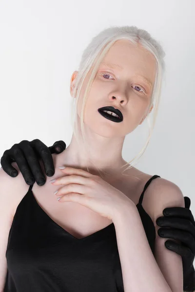 Männliche Hände in schwarzer Farbe umarmen Albino-Modell isoliert auf weiß — Stockfoto