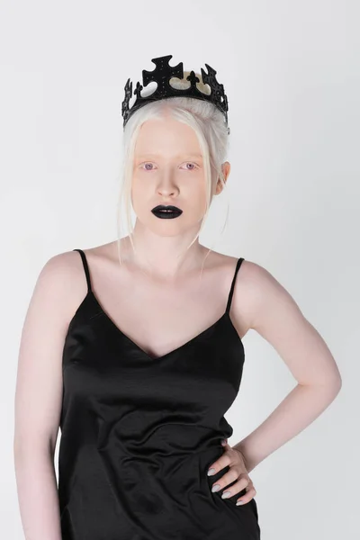 Hübsche Albino-Frau in schwarzem Kleid und Krone blickt isoliert auf weiße Kamera — Stockfoto