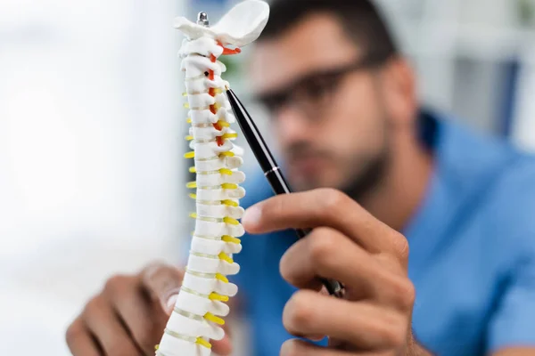 Especialista en rehabilitación borrosa apuntando con pluma en el modelo de columna vertebral - foto de stock