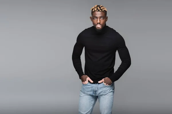 African american man with vitiligo posing with hands in pockets of jeans isolated on grey — стоковое фото