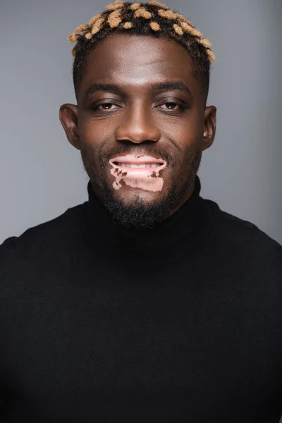 Sonriente hombre afroamericano con vitiligo y peinado elegante mirando a la cámara aislada en gris - foto de stock