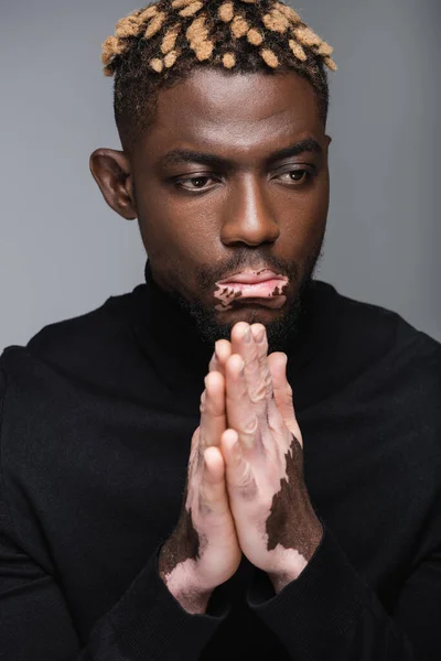 Stylish african american man with vitiligo skin and praying hands isolated on grey — Fotografia de Stock
