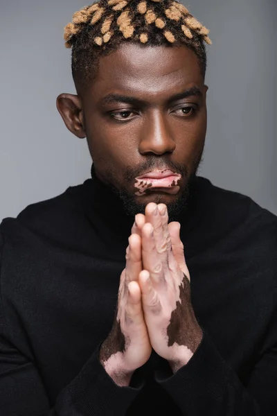 Hombre afroamericano elegante con piel de vitiligo y manos de oración aisladas en gris - foto de stock