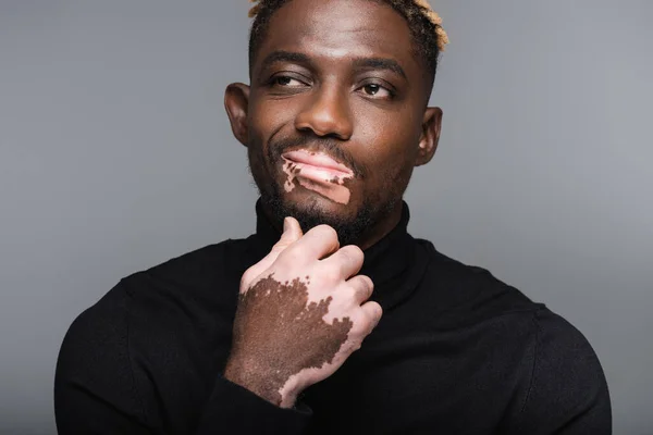 African american man with vitiligo and skeptical face expression touching chin isolated on grey — Foto stock